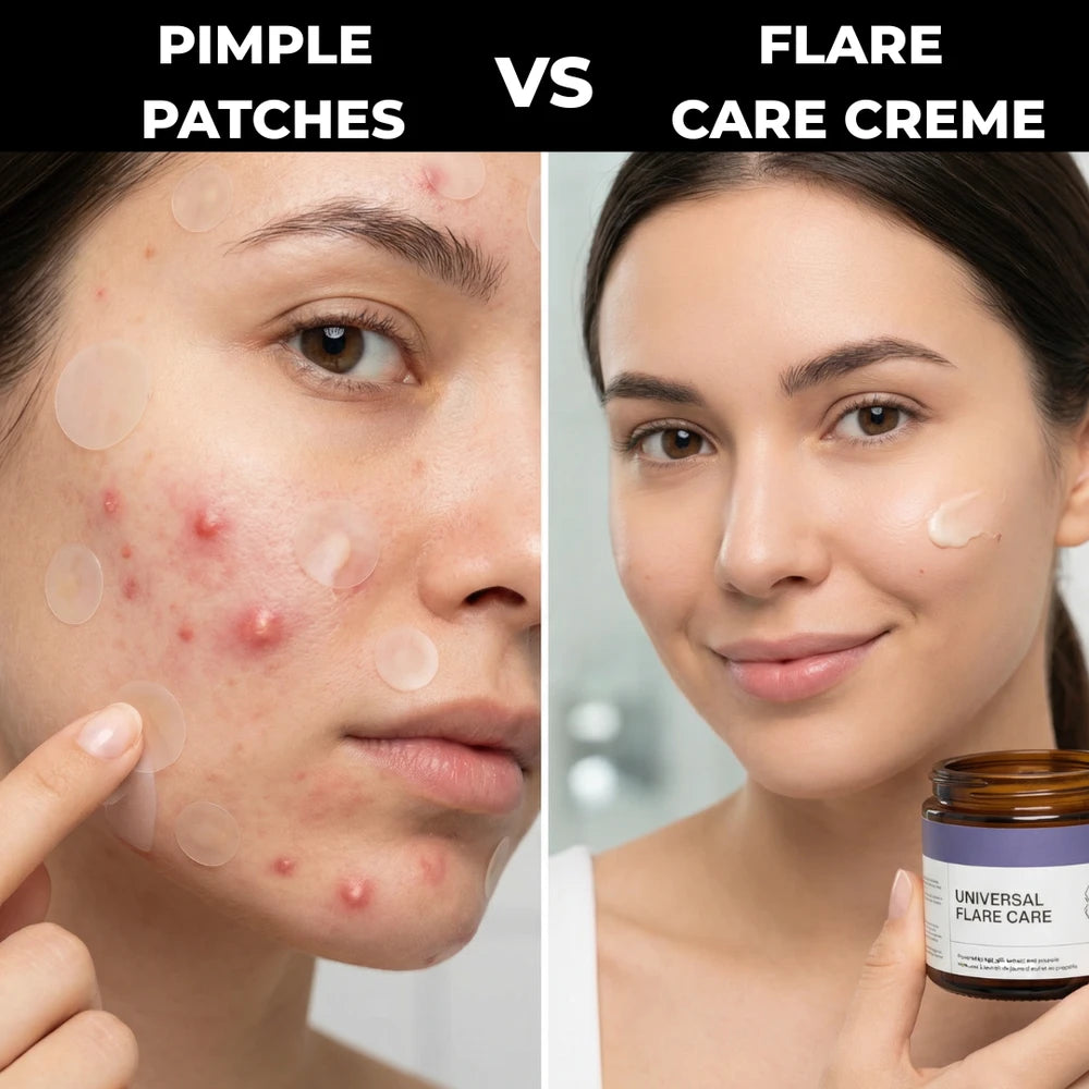 Flare Care Cream