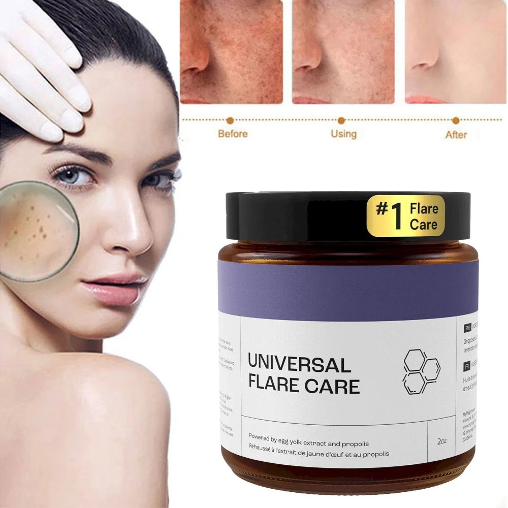 Flare Care Cream