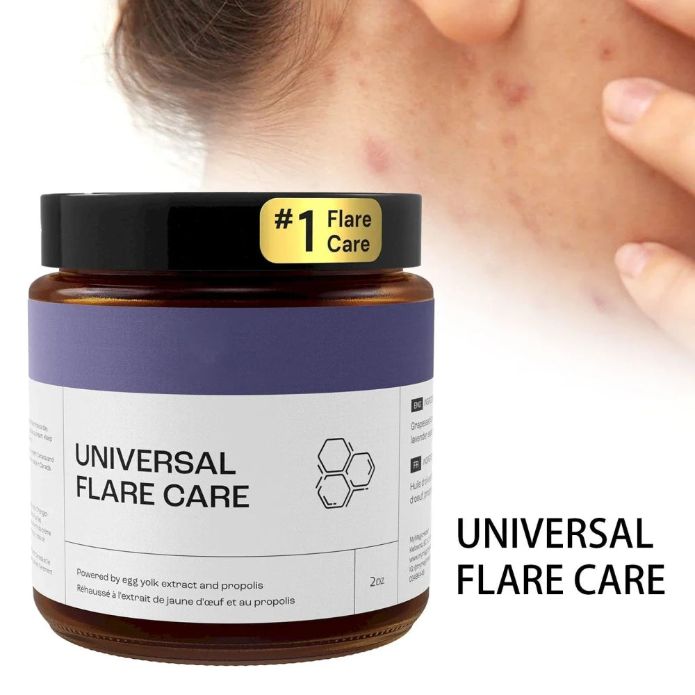 Flare Care Cream