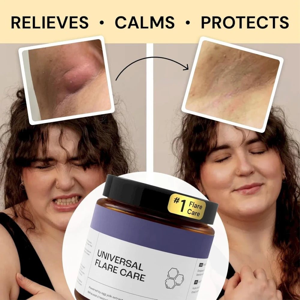 Flare Care Cream
